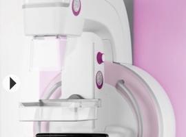 Tomosíntesis: tecnología clave para detección precoz del cáncer de mama 