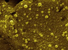 Estudian el comportamiento de metales nanométricos, con aplicaciones en medicina o energía