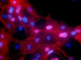 CancerSEEK es capaz de identificar ocho tipos de tumores en fases tempranas