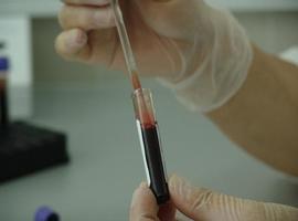 ¿Cómo detectar el cáncer de próstata