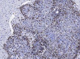 Inmunoterapia e inhibidor hormonal contra tumores de colon agresivos
