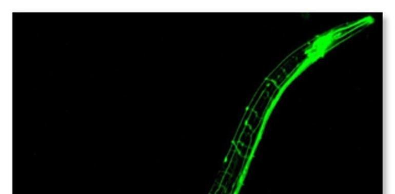 El Centro de Investigación del Cáncer estudia la apoptosis en el gusano 