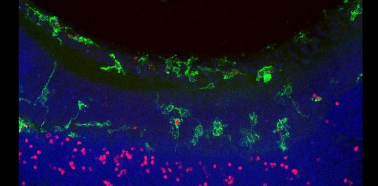 Indicios sobre la influencia de células del sistema nervioso en la degeneración de la retina