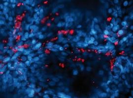 Nanoanticuerpos para impedir infecciones intestinales por ‘E. coli’ enterohemorrágica