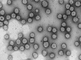 Dos proyectos del CSIC obtienen financiación europea urgente para investigar el coronavirus de Wuhan