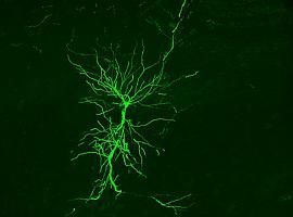 IA para entender cómo la diversidad neuronal determina la actividad del hipocampo