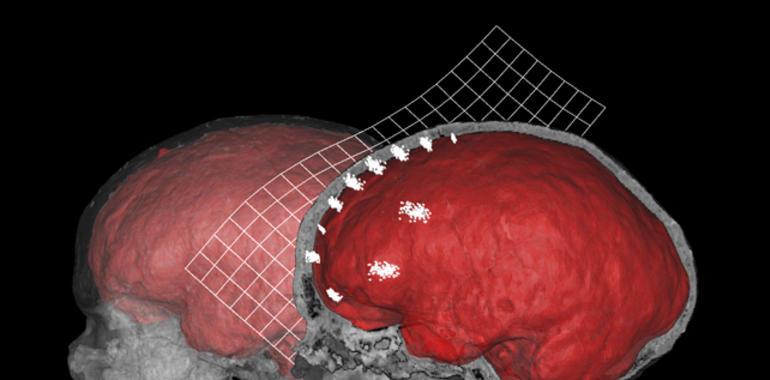 Analizan la influencia en la evolución humana de la anatomía interna del cráneo y el hueso frontal