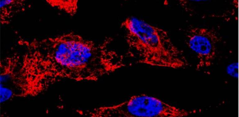 Explorando el uso de nanopartículas magnéticas para tratar el cáncer