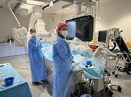 El HUCA marca un hito en la angioplastia: Primera intervención en España con sistema guiado de última generación