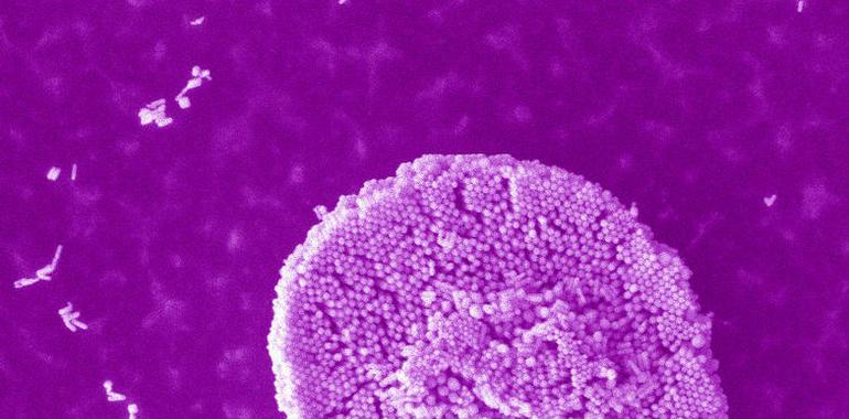 Un nuevo sensor detecta la presencia de proteínas infecciosas en la sangre 