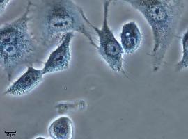 Un estudio del CSIC logra un avance revolucionario en la eliminación selectiva de células cancerosas utilizando 'jaulas' moleculares