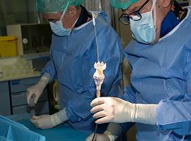 El Huca, pionero en Europa con una innovadora válvula cardiaca para tratar cardiopatías congénitas graves