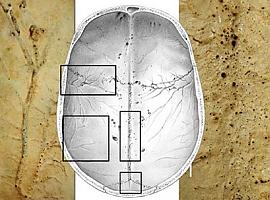 Descubren en el cráneo una red de microcanales que podría ser clave en el Alzheimer, el ictus y la depresión