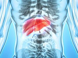 El CSIC abre una nueva vía contra un cáncer de hígado letal: atacar al entorno del tumor en lugar de a las células cancerígenas
