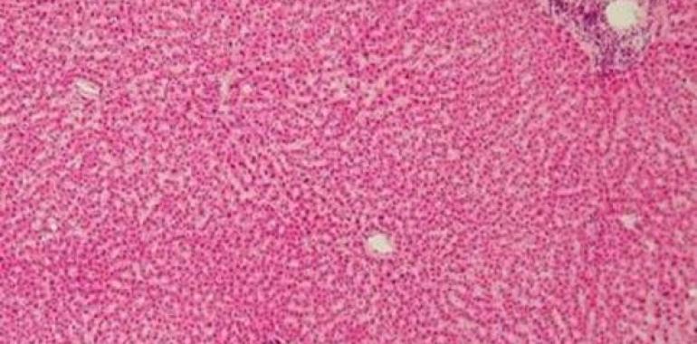 Demuestran cómo el virus de la hepatitis C consigue sobrevivir en el hígado