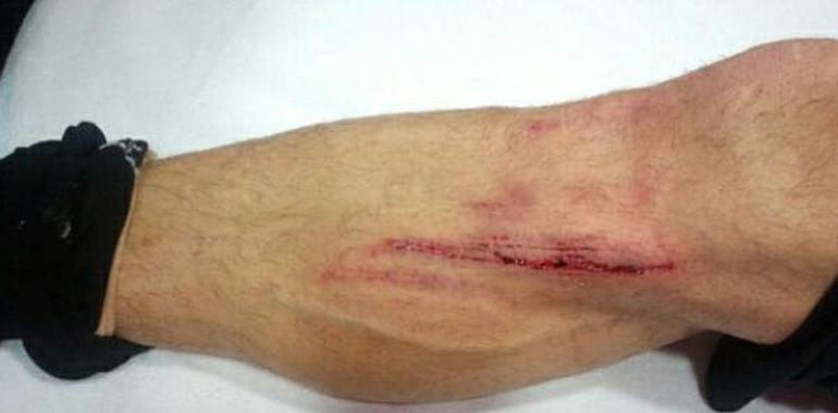 Así acabó la pierna de Mate Bilic tras el entrenamiento de hoy