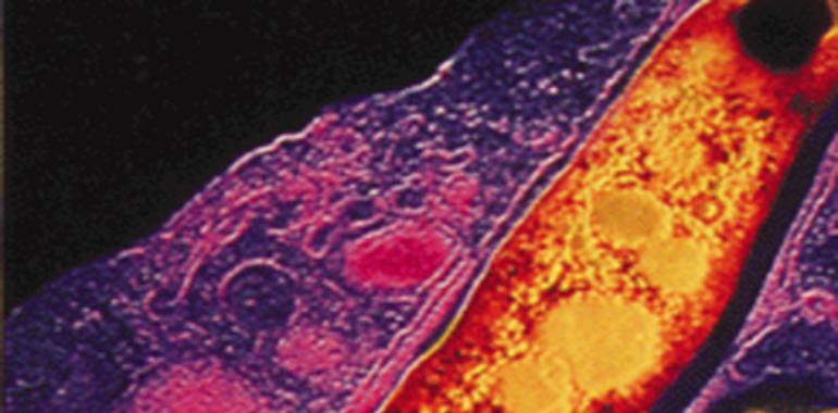 Las bacterias más raras escapan a la detección