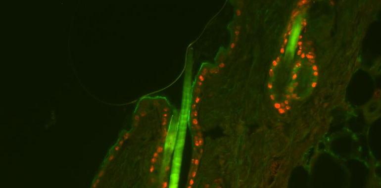 Científicos del CIEMAT utilizan nuevas tecnologías para identificar genes causantes del cáncer