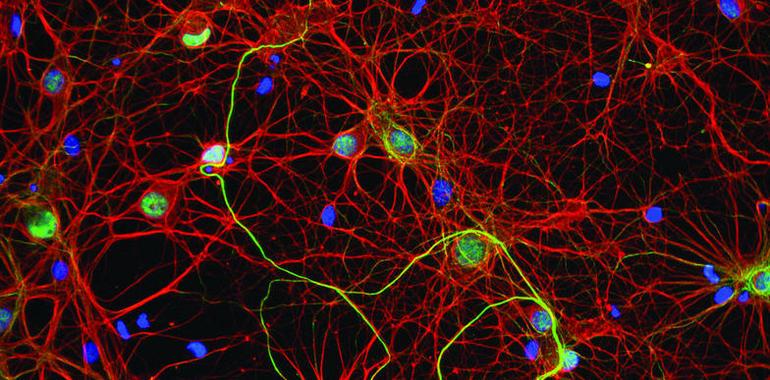 Colisiones neuronales al azar podrían explicar las diferencias cerebrales entre individuos 