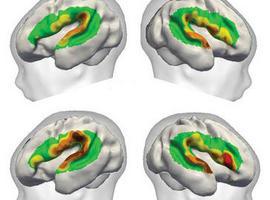 El cerebro humano puede distinguir sílabas tres meses antes de nacer