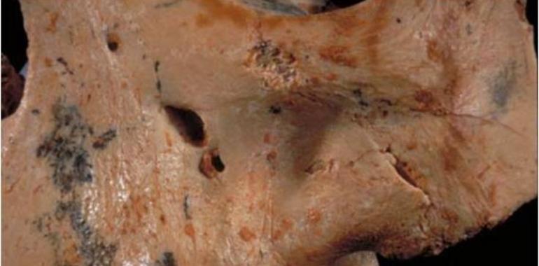El canibalismo del ‘Homo antecessor’ no era por hambre