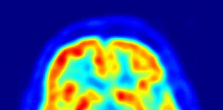 Una nueva molécula posee aplicaciones potenciales para el párkinson