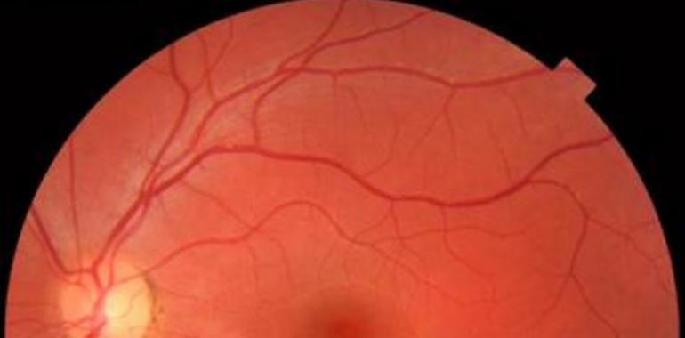 La regeneración de las neuronas de la retina ya es posible