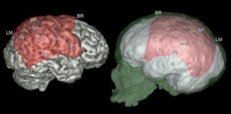 La evolución de los huesos parietales se relaciona con cambios cerebrales en el género 