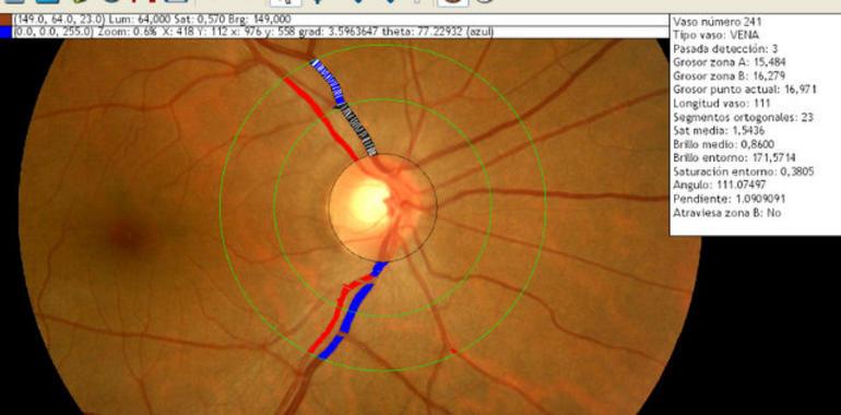 Instituto Fernández-Vega presenta los últimos avances en retina y vítreo