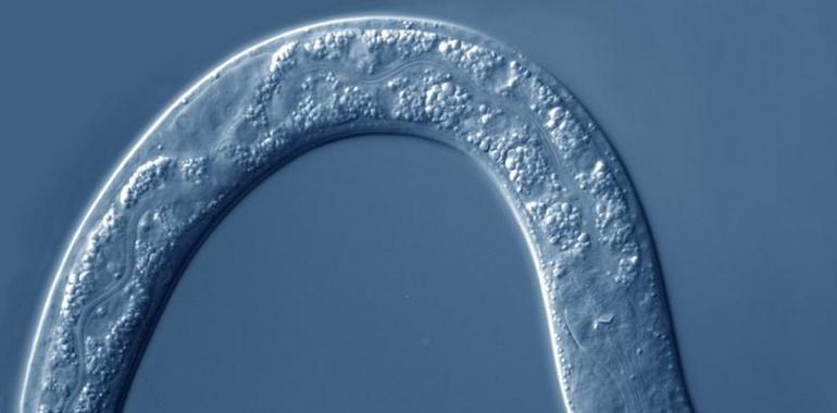 #Enfermedades #Raras. #LEMD2 sugiere posibles vínculos con #laminopatías