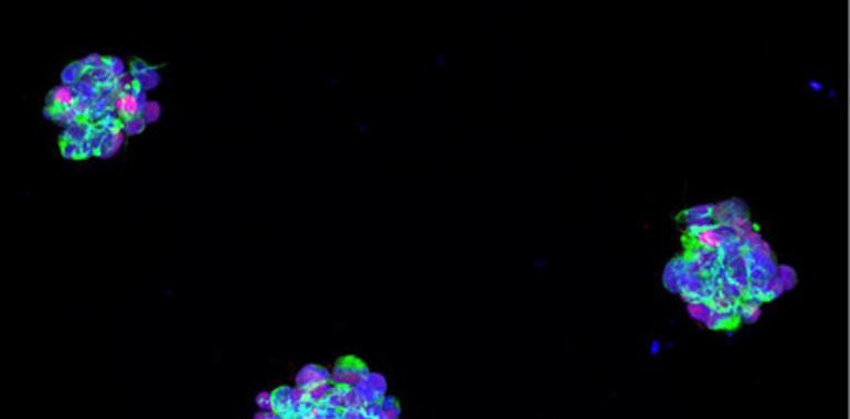 Pequeñas, pero matonas: microesferas contra el #glioblastoma