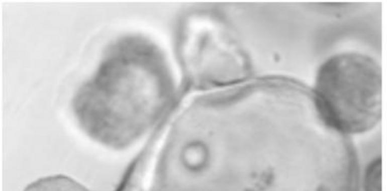 Consiguen identificar por primera vez células madre de colon humanas