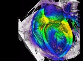 Premio para un trabajo de investigadores de UniOvi que relaciona biomarcadores con la práctica deportiva