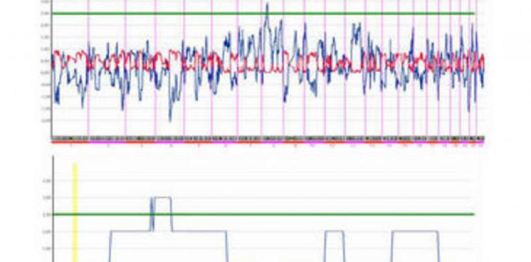 Más cerca de hallar las causas  de la diabetes monogénica