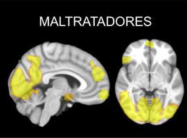 Los cerebros de los maltratadores son diferentes a los de otros delincuentes