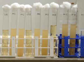 Un estudio del CSIC identifica las enzimas responsables de la resistencia a antibióticos