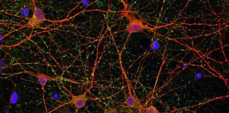 Un estudio del CSIC identifica una molécula para el potencial tratamiento del ictus