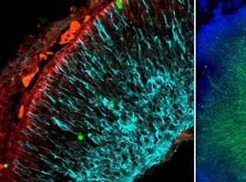 Identificada una nueva molécula ‘multipotente’ para el tratamiento de la enfermedad de Alzheimer